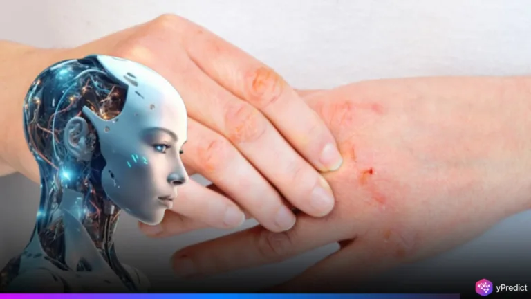Eczema AI Breakthrough-Smartphone Tool Tracks Atopic Dermatitis
