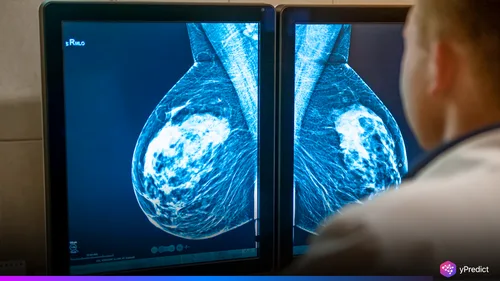 Mammography